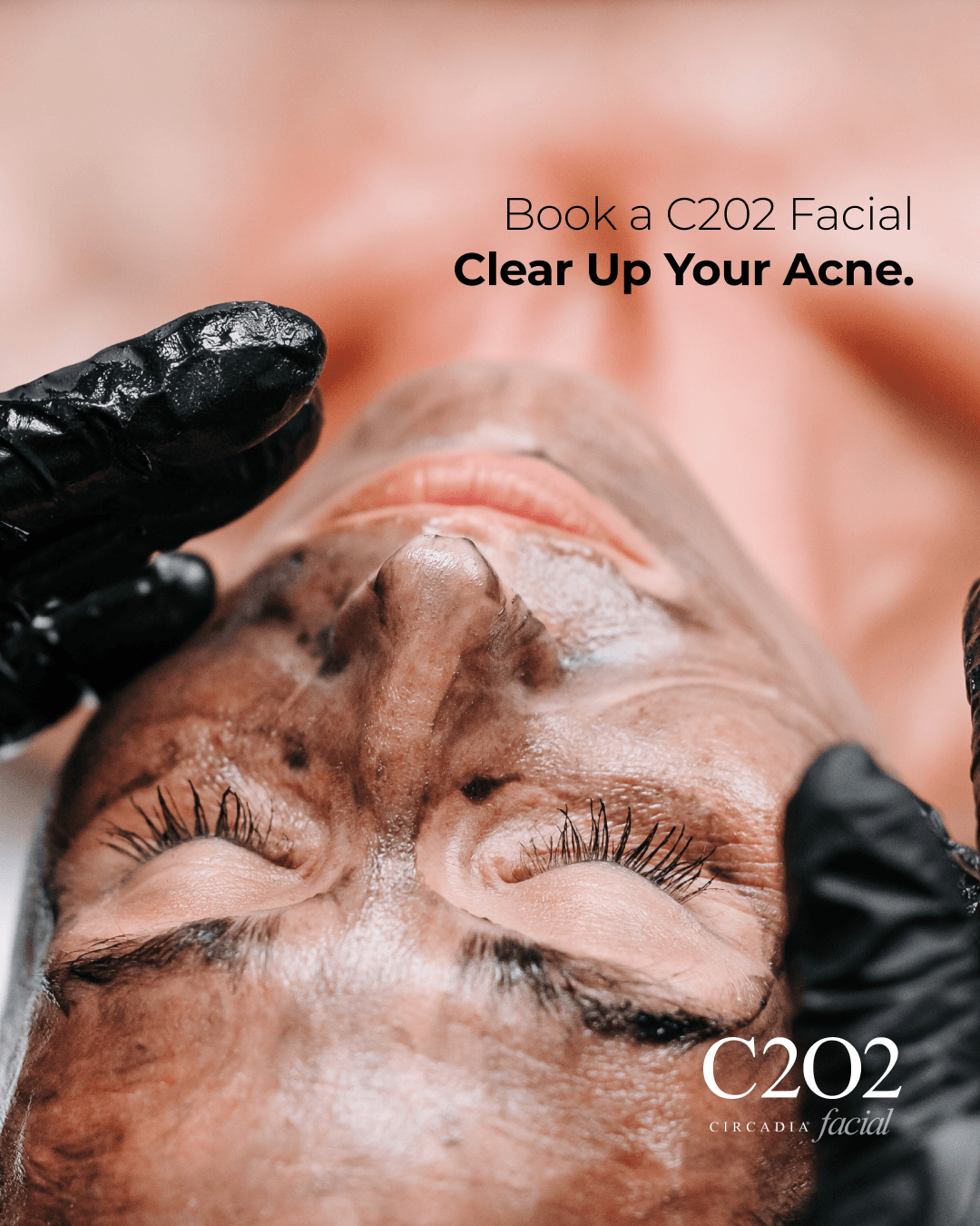 Charcoal + Oxygen Glow Facial