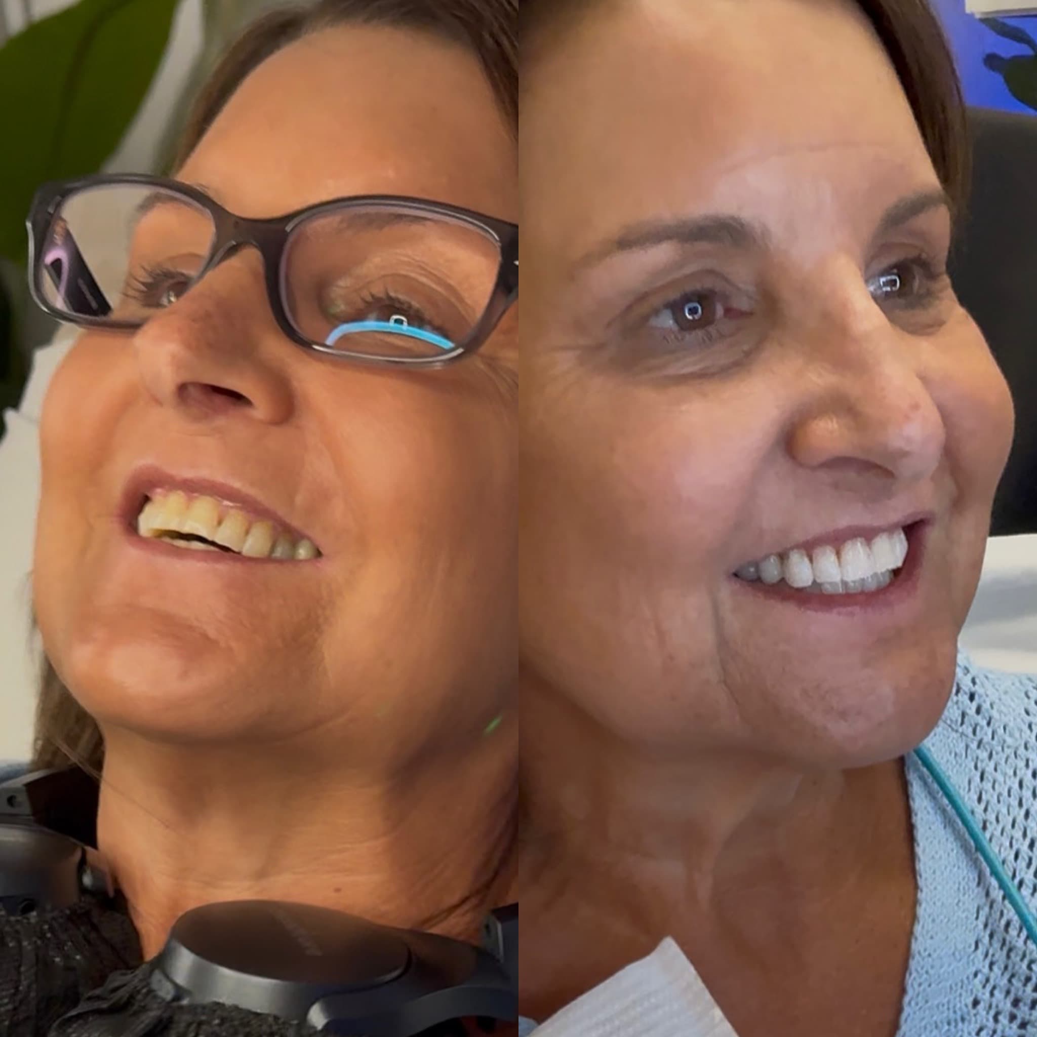 Returning Client Whitening (Returning clients only)